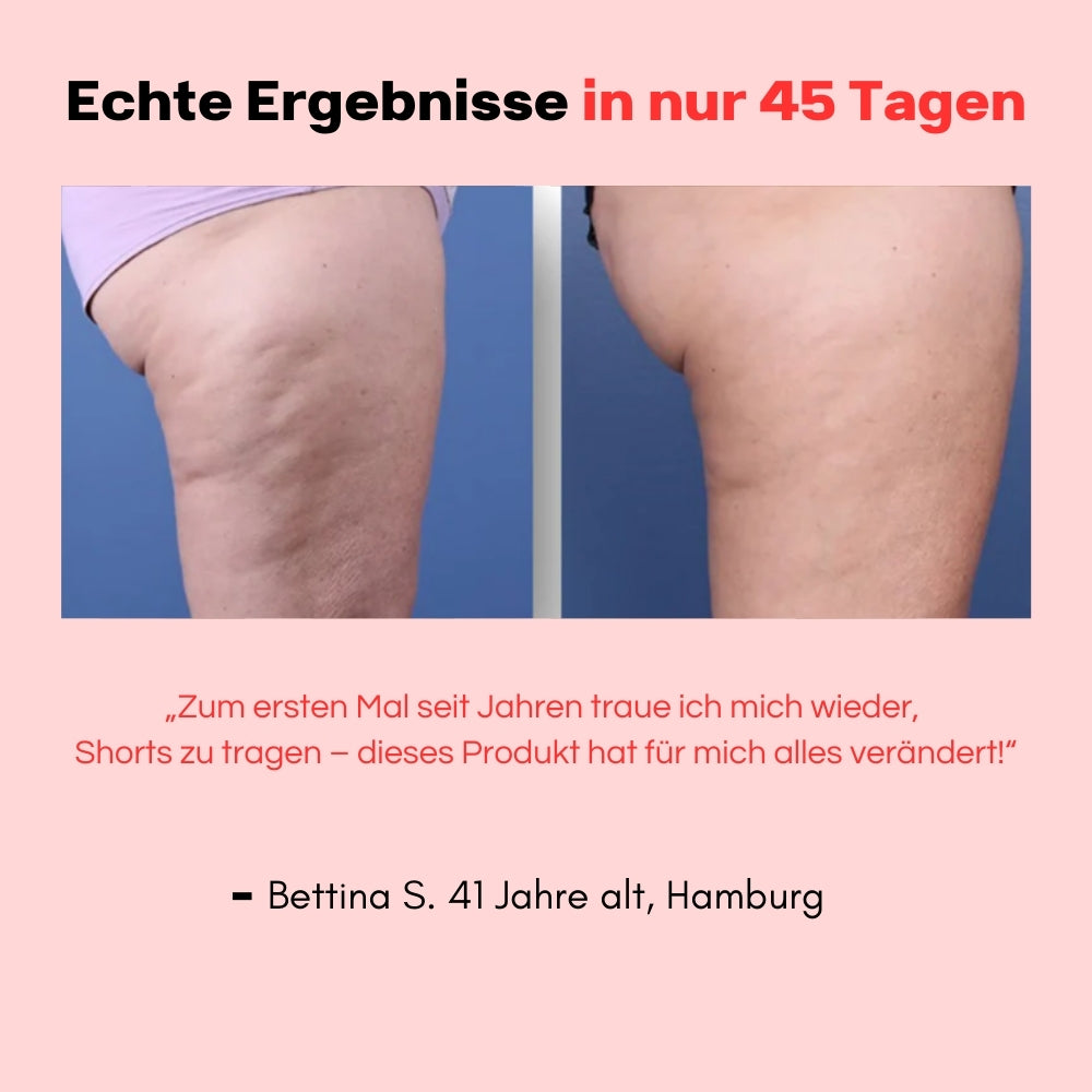 Hanna Sculpt – 3in1 Anti-Cellulite System