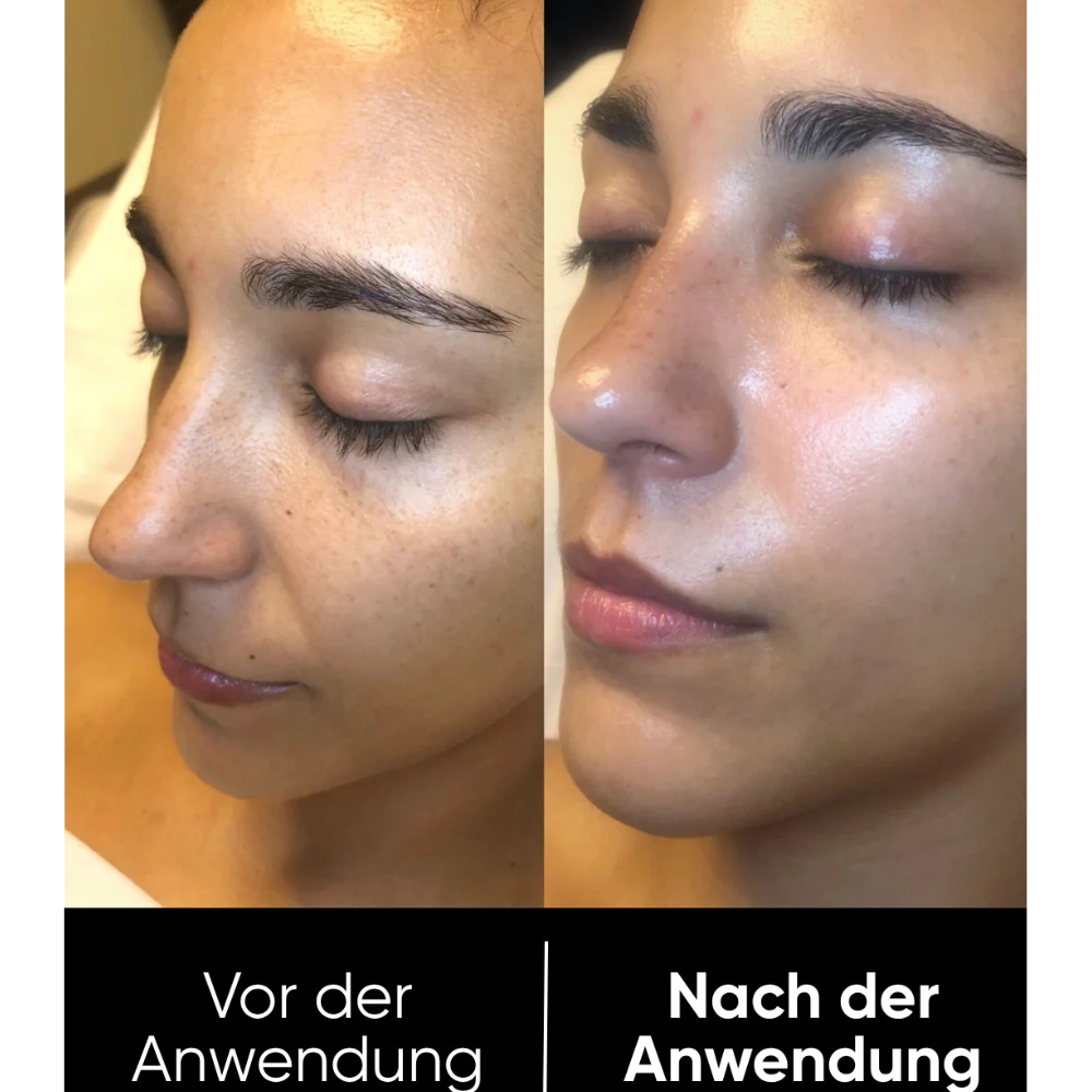 Hanna Reis Peel Shot Duo - Des pores plus fins & une peau plus lisse en seulement 3 minutes