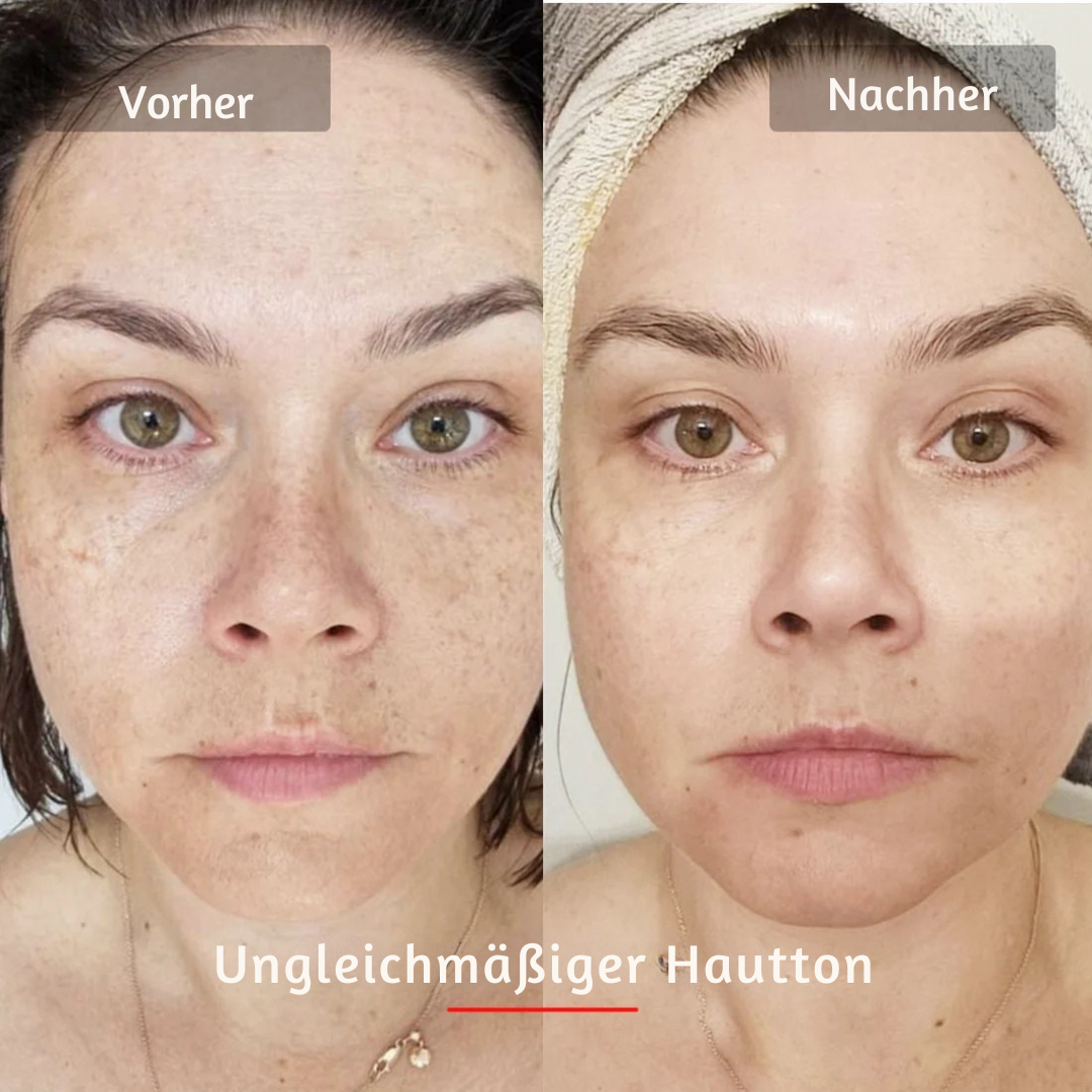 Masque LED visage HANNA PRO – Pour une peau plus lisse, plus ferme et visiblement plus fraîche